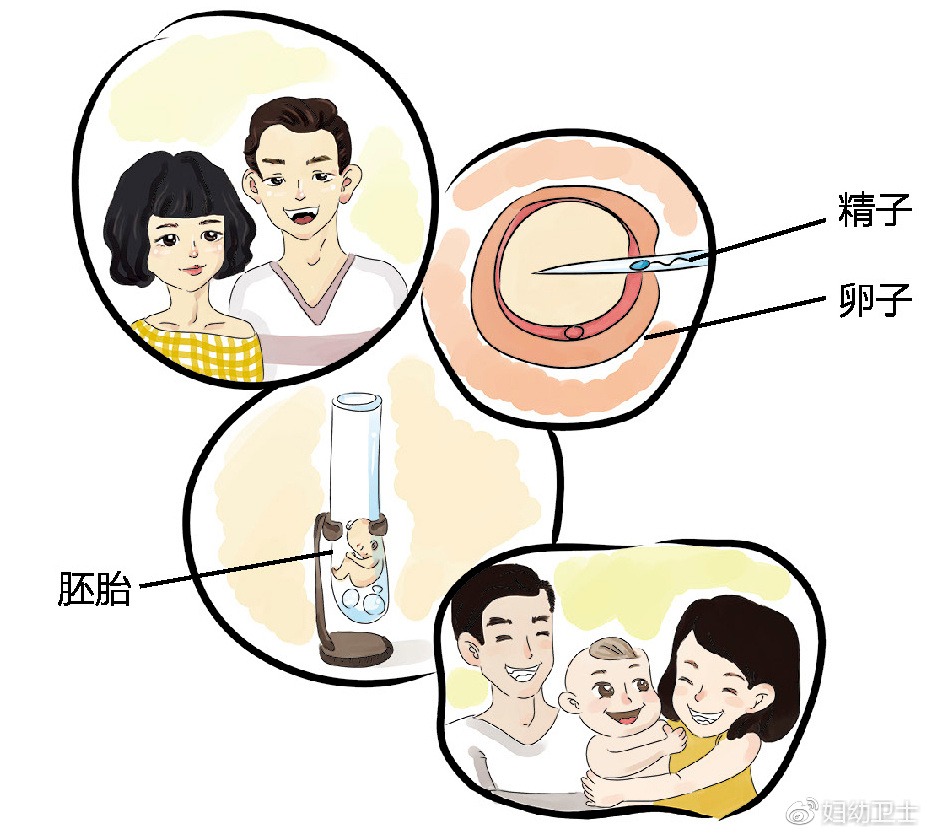 分娩