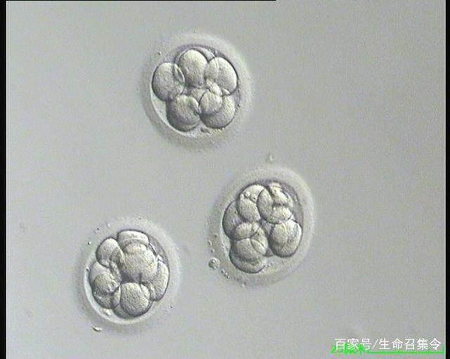 分娩视频
