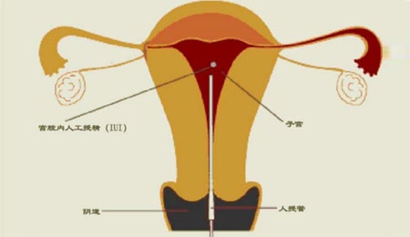 分娩