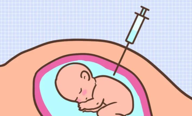 刚出生婴儿