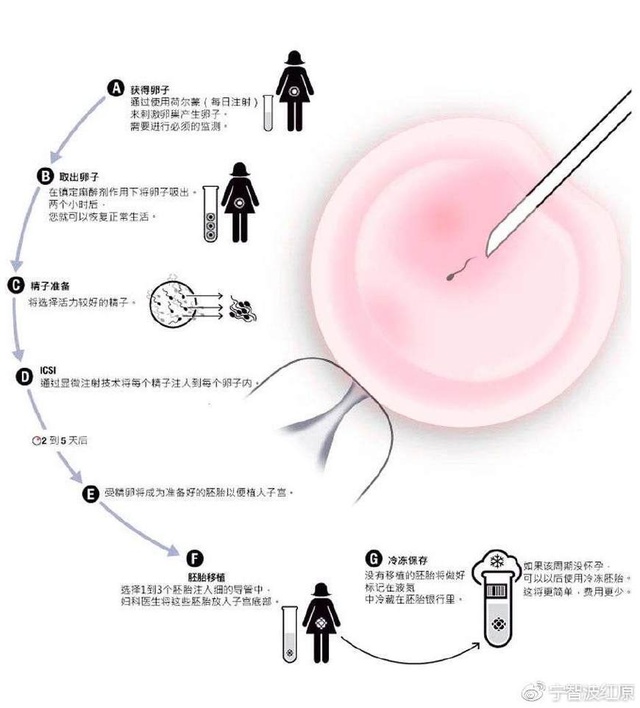 分娩顺产实拍第一视角