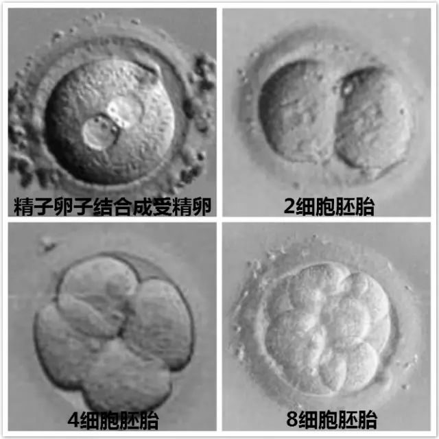 分娩