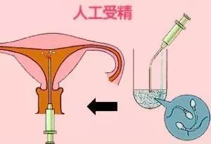 自然流产