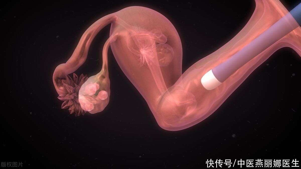 先兆流产