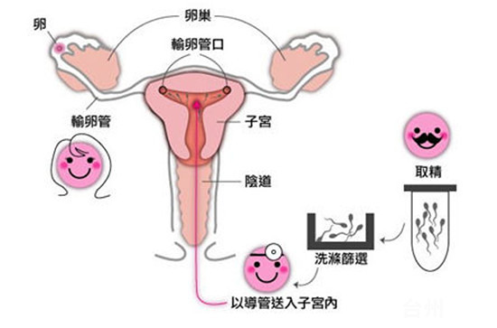 怀孕初期