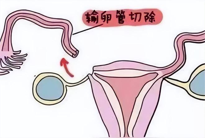 怀孕初期