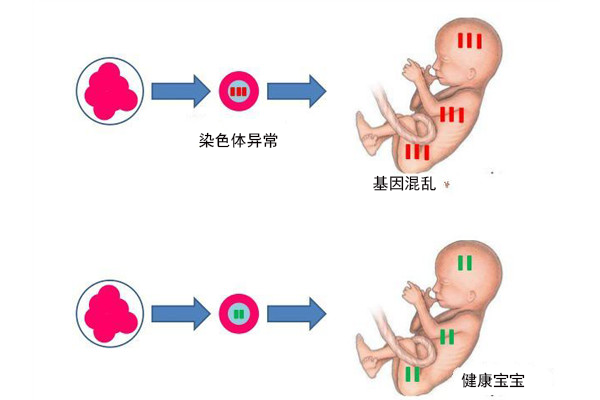 初生儿