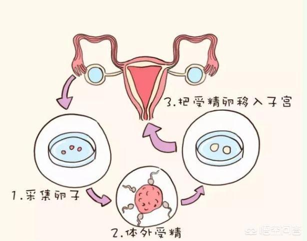 怀孕检测