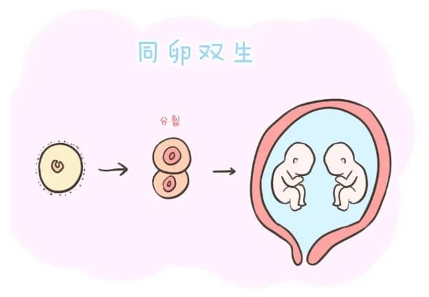 流产