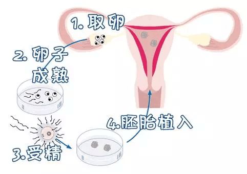 四平有偿招聘捐卵女孩