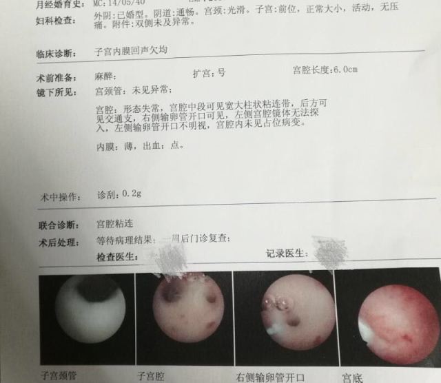 四川捐卵补偿